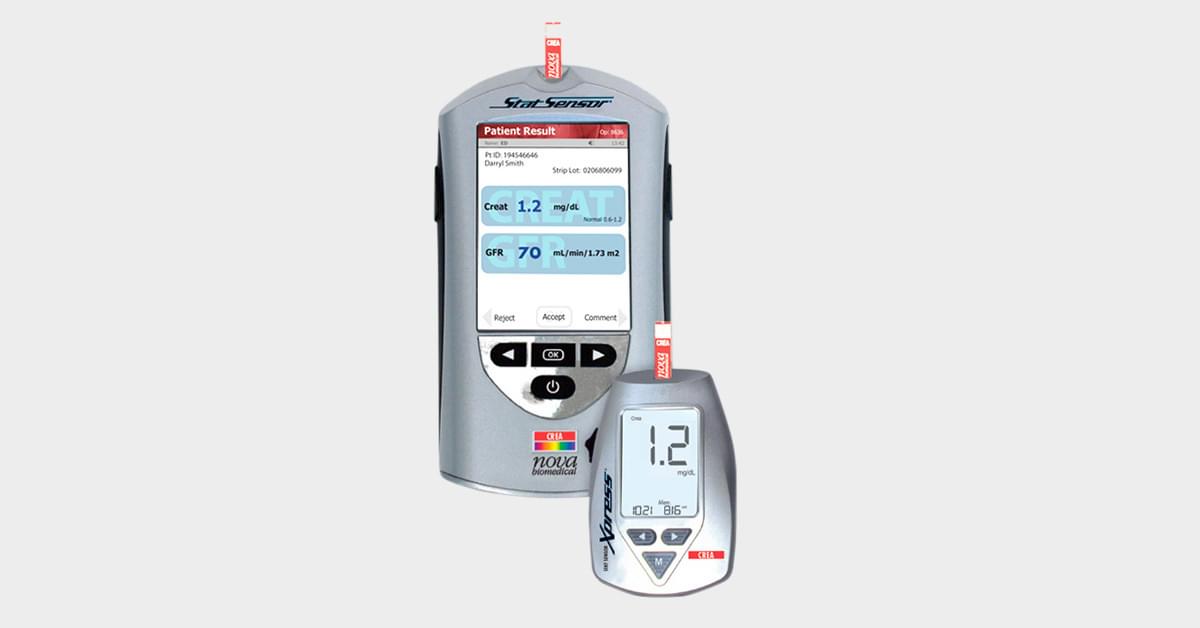 Nova Biomedical’s StatSensor® Creatinine handheld analyzer