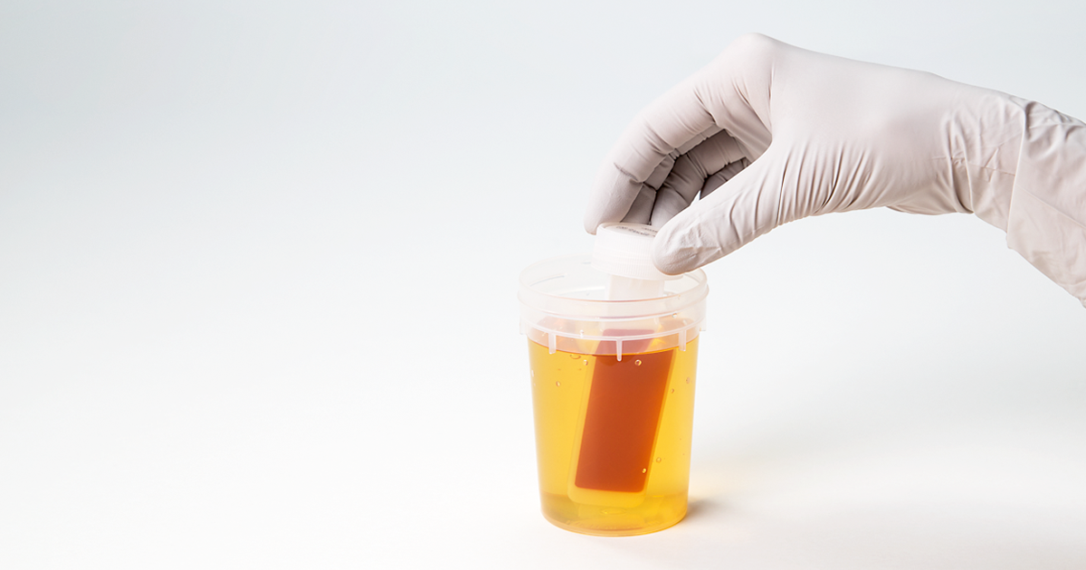 Uricult dipped in urine