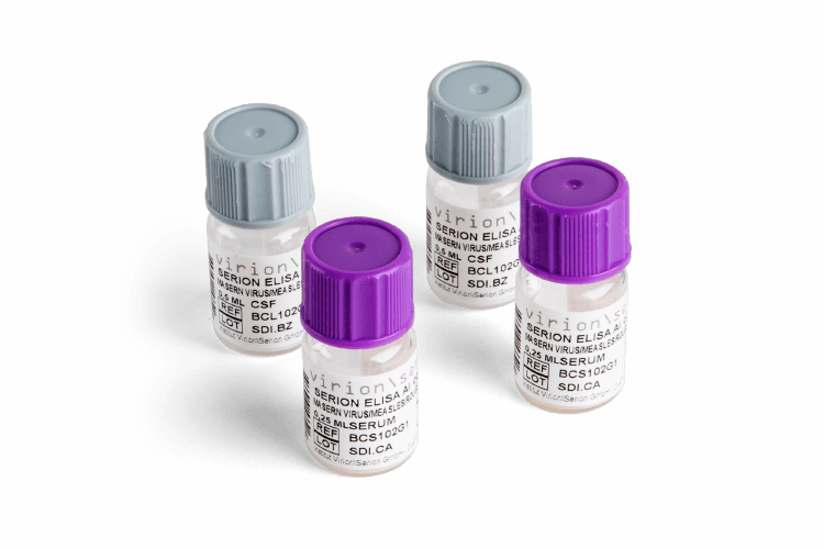Elisa controles Serion Verion Borrelia Elisa controles Serion Verion Borrelia